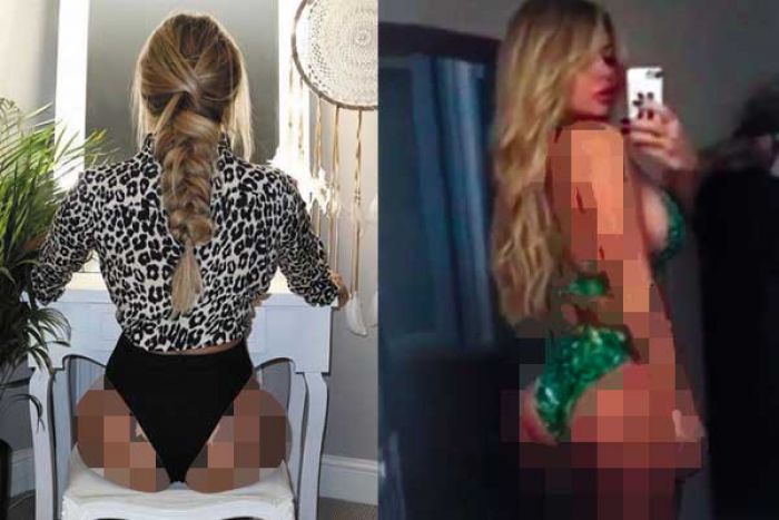 ​Menderita Sindrom Dysmorphia, Bokong Bianca Gascoigne Dipermak Jadi Bulat Berisi