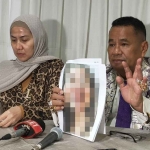 Venna Melinda saat bersama kuasa hukumnya, Hotman Paris saat menunjukkan bukti KDRT yang dilakukan Ferry Irawan.