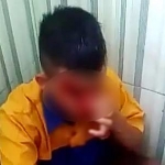 Kondisi korban saat dianiaya pelaku.