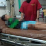 Salah satu pelajar SMPN 4 Surabaya yang menjadi korban pengeroyokan oleh temannya di Jalan Mawar, Tegalsari, Surabaya.