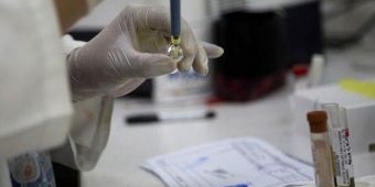 Dinkes Lamongan Antisipasi Virus Zika