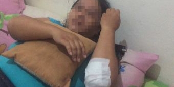 Diduga Jadi Korban Kecelakaan, Wanita di Jalan Undaan Wetan Surabaya Ternyata Korban Jambret