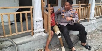 Kapolres Probolinggo Kota Belikan Kaki Palsu untuk Siswi SDN Sumberbendo I