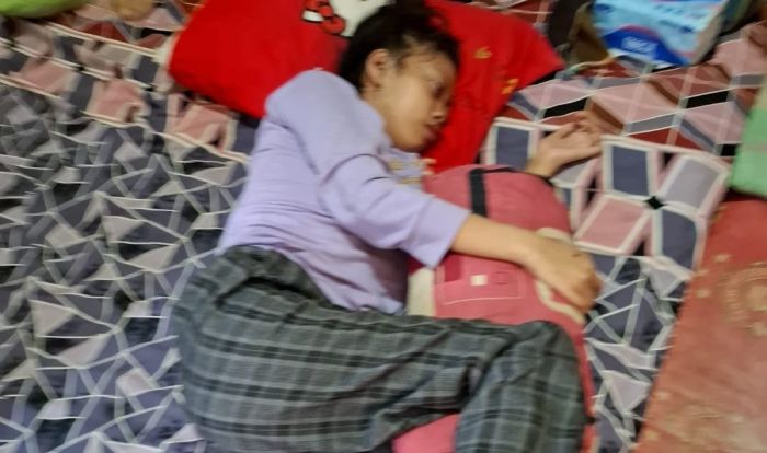 Pemkab Kediri Bantu Vanessa Siswi SMP yang Mengidap Kanker Otak untuk Dioperasi di RSAL Surabaya