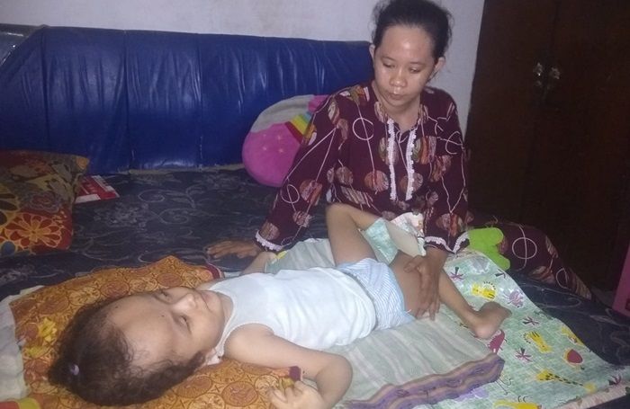 Ayo Bantu Sasa, Bocah Penderita Hidrosefalus di Sidoarjo yang Ditinggal Pergi Sang Ayah