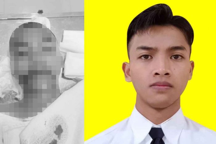 Diduga Dianiaya Senior, Siswa Poltekpel Surabaya Meninggal Dunia Babak Belur