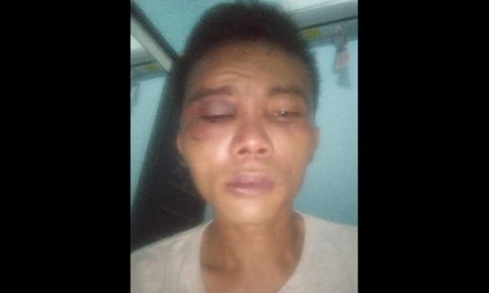 Diduga Ada Keterlibatan Oknum, Kuasa Hukum Korban Penganiayaan: Penanganan Terkesan "Lemot"