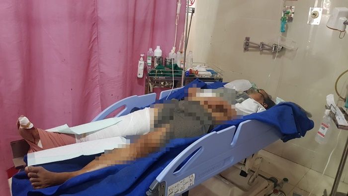 Diseruduk Motor, Nyawa Nenek di Blitar Selamat Meski Luka Parah, Sempat Dikabarkan Meninggal Dunia