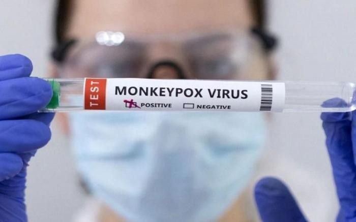 Ketahui 5 Cara Penularan Mpox yang Perlu Diwaspadai