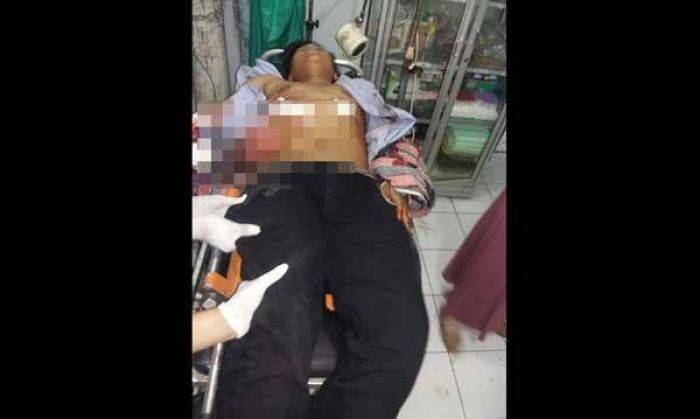 Cemburu, Pria di Surabaya ini Bacok Pacar Mantan Istri hingga Usus Keluar