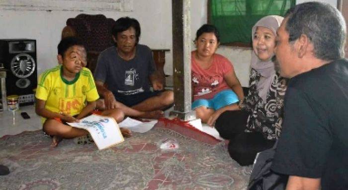 Bocah di Tulungagung Derita Tumor Jinak, Tak Sekolah