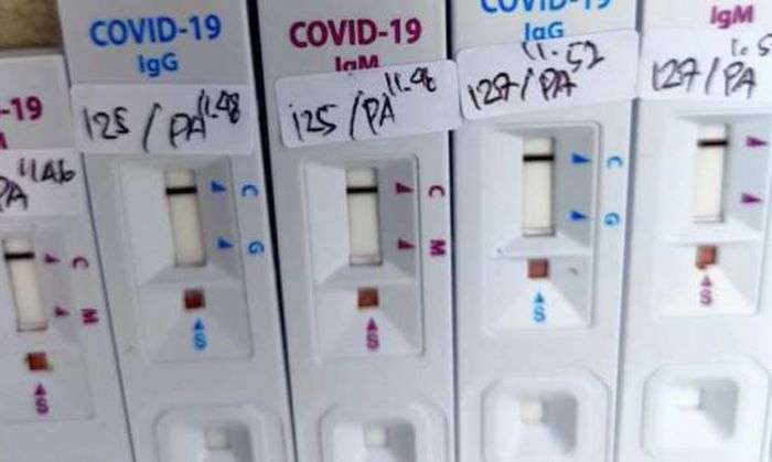 Hasil Rapid Test 12 Santri Ponpes Temboro Asal Pacitan Dinyatakan Reaktif Covid-19