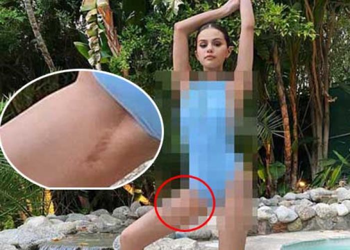 ​Selena Gomez Pamer Bekas Sayatan Operasi Transplantasi Ginjal