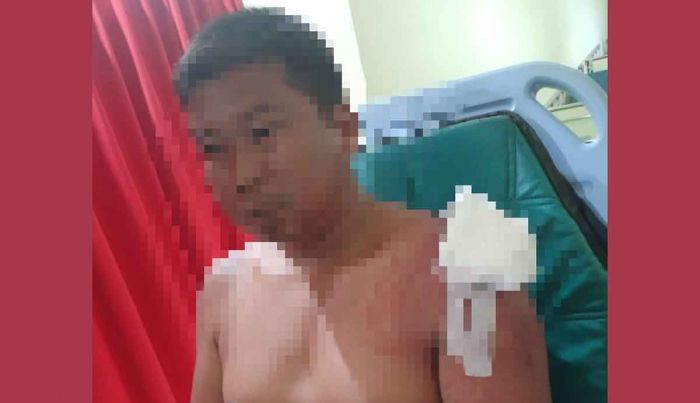 Pria di Blitar Dibacok Saudara Ipar, Polisi Paparkan Kronologinya