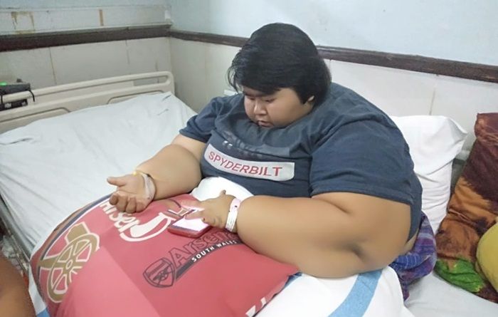 ​Gadis Berbobot 142 Kg Asal Sidoarjo Akhirnya Meninggal Dunia