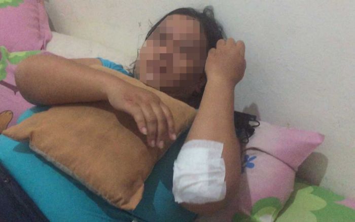 Diduga Jadi Korban Kecelakaan, Wanita di Jalan Undaan Wetan Surabaya Ternyata Korban Jambret